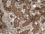 RCAS1 Antibody in Immunohistochemistry (Paraffin) (IHC (P))