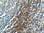 SERPING1/C1 Inactivator Antibody in Immunohistochemistry (Paraffin) (IHC (P))