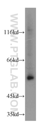 SERPING1/C1 Inactivator Antibody in Western Blot (WB)