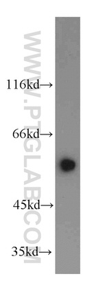 SERPING1/C1 Inactivator Antibody in Western Blot (WB)