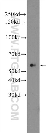 SERPING1/C1 Inactivator Antibody in Western Blot (WB)