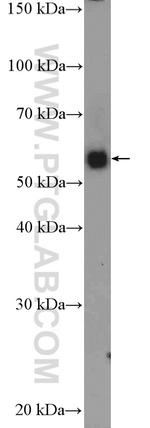 SERPING1/C1 Inactivator Antibody in Western Blot (WB)