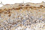 SERPING1/C1 Inactivator Antibody in Immunohistochemistry (Paraffin) (IHC (P))