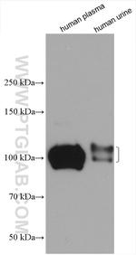 SERPING1/C1 Inactivator Antibody in Western Blot (WB)