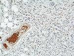 SULF2 Antibody in Immunohistochemistry (Paraffin) (IHC (P))