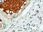 SULF2 Antibody in Immunohistochemistry (Paraffin) (IHC (P))