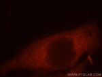 CCT8 Antibody in Immunocytochemistry (ICC/IF)