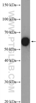 CCT8 Antibody in Western Blot (WB)