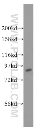 DHX15 Antibody in Western Blot (WB)