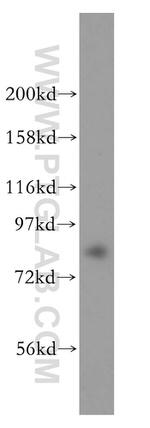 DHX15 Antibody in Western Blot (WB)