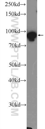 DHX15 Antibody in Western Blot (WB)