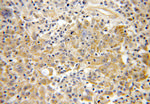 MTHFD2 Antibody in Immunohistochemistry (Paraffin) (IHC (P))