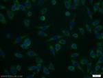 UCK1 Antibody in Immunocytochemistry (ICC/IF)