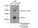 UCK1 Antibody in Immunoprecipitation (IP)