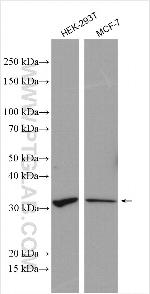 UCK1 Antibody in Western Blot (WB)