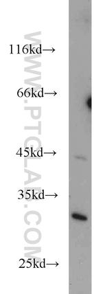 UCK1 Antibody in Western Blot (WB)