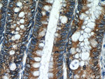 AGR2 Antibody in Immunohistochemistry (Paraffin) (IHC (P))