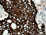 AGR2 Antibody in Immunohistochemistry (Paraffin) (IHC (P))