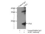 AGR2 Antibody in Immunoprecipitation (IP)