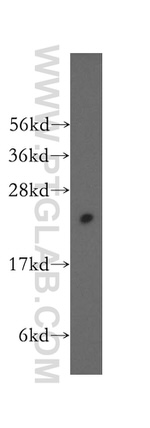 AGR2 Antibody in Western Blot (WB)