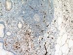 Calretinin Antibody in Immunohistochemistry (Paraffin) (IHC (P))