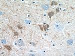 Calretinin Antibody in Immunohistochemistry (Paraffin) (IHC (P))