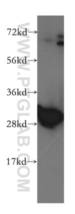 Calretinin Antibody in Western Blot (WB)