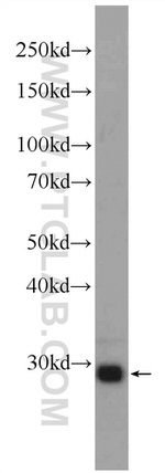 Calretinin Antibody in Western Blot (WB)