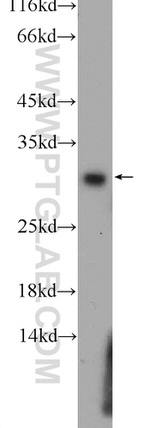 Calretinin Antibody in Western Blot (WB)