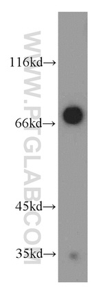 LEO1 Antibody in Western Blot (WB)