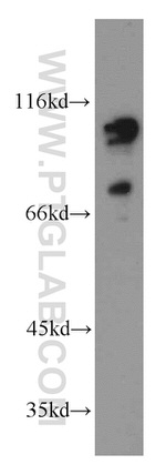 LEO1 Antibody in Western Blot (WB)