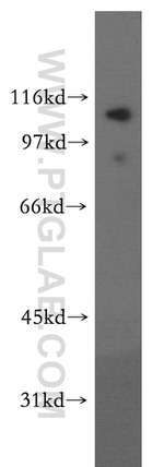 LEO1 Antibody in Western Blot (WB)