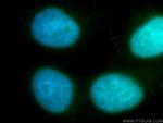 ZWINT Antibody in Immunocytochemistry (ICC/IF)