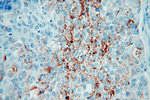 Clusterin Antibody in Immunohistochemistry (Paraffin) (IHC (P))