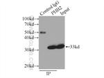 Prohibitin 2 Antibody in Immunoprecipitation (IP)