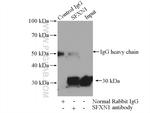 SFXN1 Antibody in Immunoprecipitation (IP)