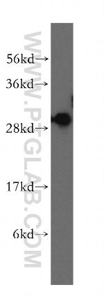 SFXN1 Antibody in Western Blot (WB)