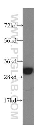 SFXN1 Antibody in Western Blot (WB)