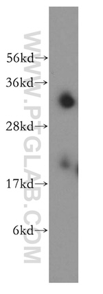 SFXN1 Antibody in Western Blot (WB)