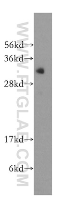 SFXN1 Antibody in Western Blot (WB)