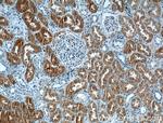 CLIC4 Antibody in Immunohistochemistry (Paraffin) (IHC (P))