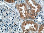 CLIC4 Antibody in Immunohistochemistry (Paraffin) (IHC (P))