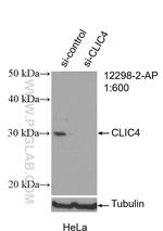 CLIC4 Antibody in Western Blot (WB)