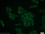 MTMR8 Antibody in Immunocytochemistry (ICC/IF)