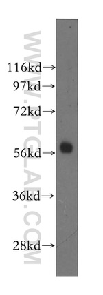 MTMR8 Antibody in Western Blot (WB)