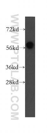 MTMR8 Antibody in Western Blot (WB)