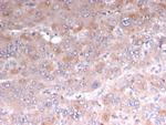 Adipophilin/Perilipin-2 Antibody in Immunohistochemistry (Paraffin) (IHC (P))