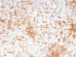 Adipophilin/Perilipin-2 (Marker of Lipid Accumulation) Antibody in Immunohistochemistry (Paraffin) (IHC (P))