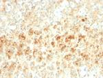 Adipophilin/Perilipin-2 Antibody in Immunohistochemistry (Paraffin) (IHC (P))