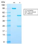 Adipophilin/Perilipin-2 Antibody in SDS-PAGE (SDS-PAGE)